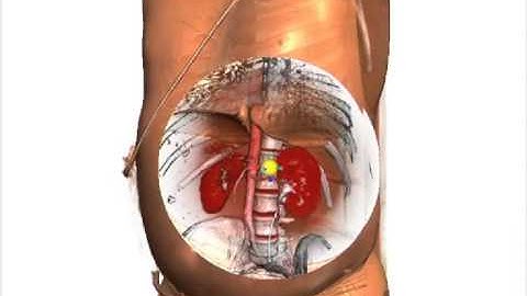 Context Preserving Focal Probes for Exploration of Volumetric Medical Datasets