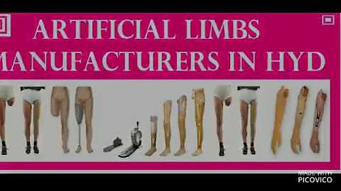Prosthetics Upper & Lower Extremity  by My Care P & O Hyderabad #mycaremedical