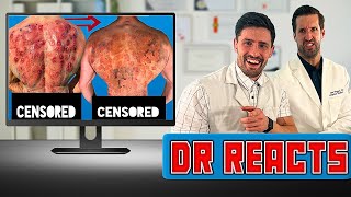 ER Doctor REACTS to my Most PAINFUL Injuries (ft. Doctor ER)