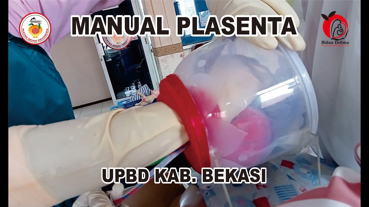 Manual Plasenta - UPBD KAB. BEKASI