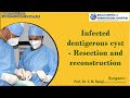 Infected Dentigerous Cyst - Resection and Reconstruction