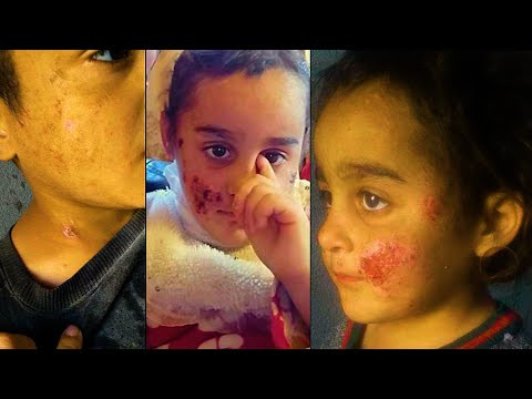 حلقة كاملة أطفال يحرقون ويعذبون من قبل ابوهم ويرميهم وسط الصحراء ويعانون من الجوع والبرد علي عذاب