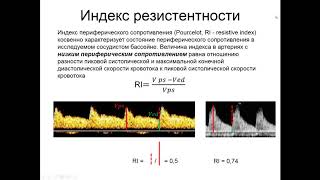 Введение в допплерографию. Часть 2