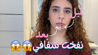 تكبير الشفايف بدون فيلرز| ريفيو وتجربة قلم نفخ الشفايف plump it?