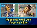 অর্থের অভাবে চিরতরে অন্ধ হয়ে যেতে পারে শিশু সাইমন | Save Saimon | Ghoraghat | Rtv News