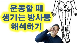 운동할 때 생기는 방사통 해석하기