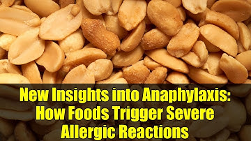 New Insights into Anaphylaxis: How Foods Trigger Severe Allergic Reactions