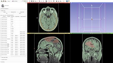 User Statistics - New module in 3D Slicer