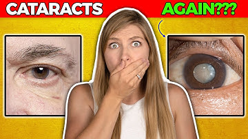 Secondary Cataract: It