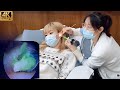 可爱姐姐反差强烈的耳屎🤭 Cute girl's unexpected earwax!