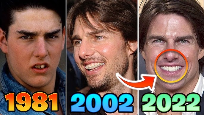 What'S Wrong With Tom Cruise' Teeth?! - Youtube