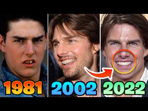 What's Wrong With Tom Cruise' Teeth?!