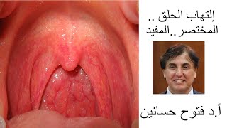 إلتهاب الحلق