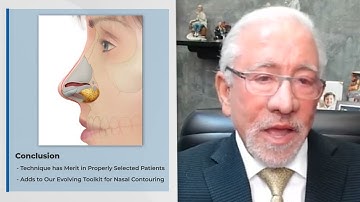 Soft Triangle Support in Rhinoplasty by Bahman Guyuron, MD