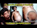 டாக்டர்களுக்கே தலை சுற்றவைத்த விஷயங்கள் | Weird Indian Diseases You Never Knew | Rishipedia | Tamil