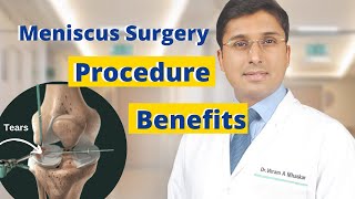 ✅ What is Meniscus Surgery? | Meniscus Tear Surgery Procedure | Care After Meniscus Surgery