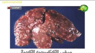 مرض الكوكسيديا  Coccidiosis  امراض الارانب 5