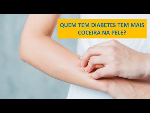 Vídeo: Marcas De Pele E Diabetes: Qual é A Conexão?