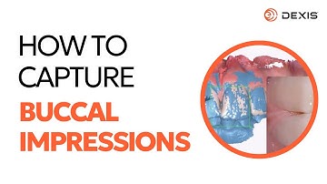 DEXIS™ IS ScanFlow - How to Capture a Buccal Dental Impression