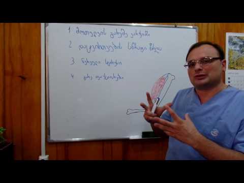 კუნთის დაჭიმულობის მიზეზები და მითი მკურნალობა