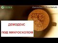 Подкожный клещ Демодекс под микроскопом 🙈🔬 Demodex Follicles Фото + Видео