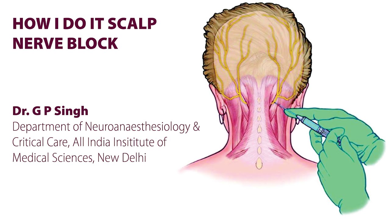 Cutaneous Nerve Blocks of the Lower Extremity - NYSORA