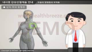 [시연용] c0079acko 내시경 갑상선절제술 안내 액와부 접근법