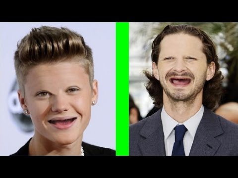 Celebrities without Teeth and Eyebrows