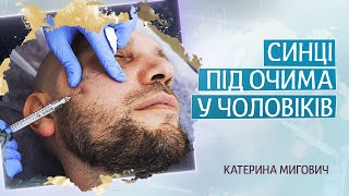 Як прибрати втомлений вигляд, синці, мішки під очима у чоловіків