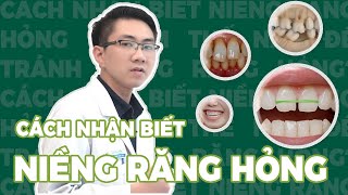 Cách Nhận Biết Niềng Răng Hỏng || Làm Thế Nào Để Tránh Niềng Răng Hỏng | Bác Sĩ Nam Bùi Vinalign