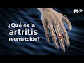 Artritis Reumatoide - #ExclusivoMSP
