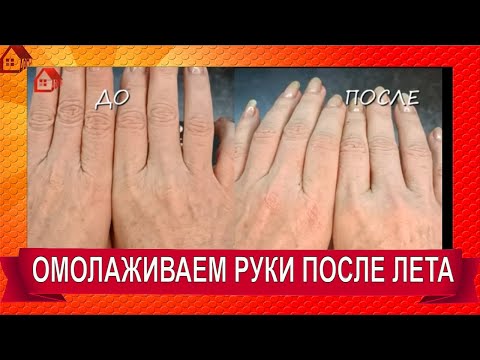 Как Омолодить Старые Руки за 10 мин. Супер способ сделать руки молодыми после лета и заготовок