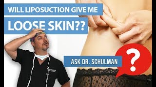 Will Liposuction Give Me Loose Skin? Ask Dr Schulman