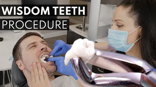 Wisdom Teeth Extraction PROCEDURE | How to Prepare, What to Expect \& Cost