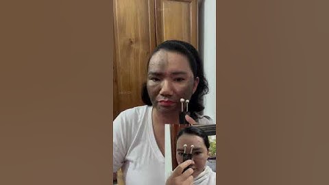 Tại sao cạo gió có người đen người không   Cạo gió bạc Bách Chi