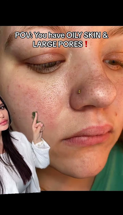 Do you have OILY SKIN & LARGE PORES?! #skincare #skincareroutine