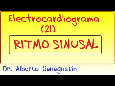 Vídeo: Ritmo Sinusal: Ritmo Sinusal Normal, Arritmia Sinusal