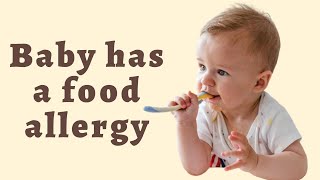 Baby Has a Food Allergy - How to Tell If My Infant Has a Milk Allergy