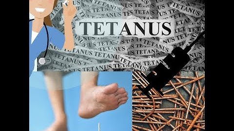 Why is it so dangerous to step on a rusty nail?