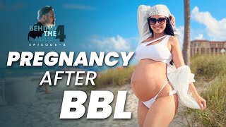 Pregnancy After a BBL: Am I  Going To Loose My Results?