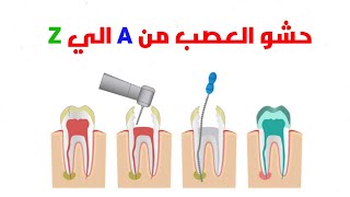 Endo from A to Z ( lower molars )- حشو العصب من الالف الي الياء