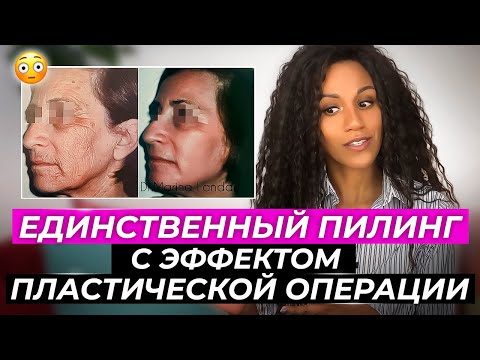 Невероятные результаты пилинга // Процедура для омоложения // Минус 20 лет