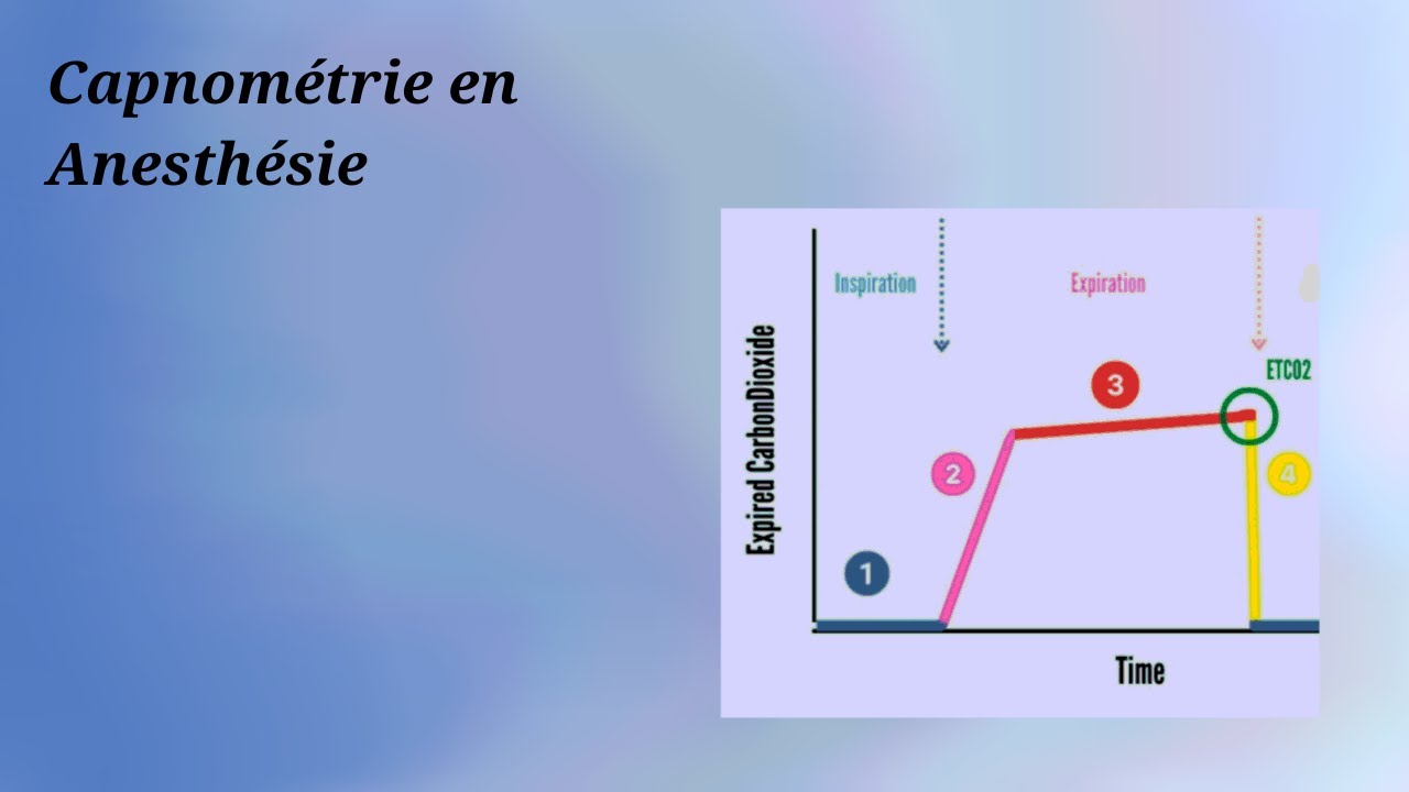 Capnométrie en Anesthésie