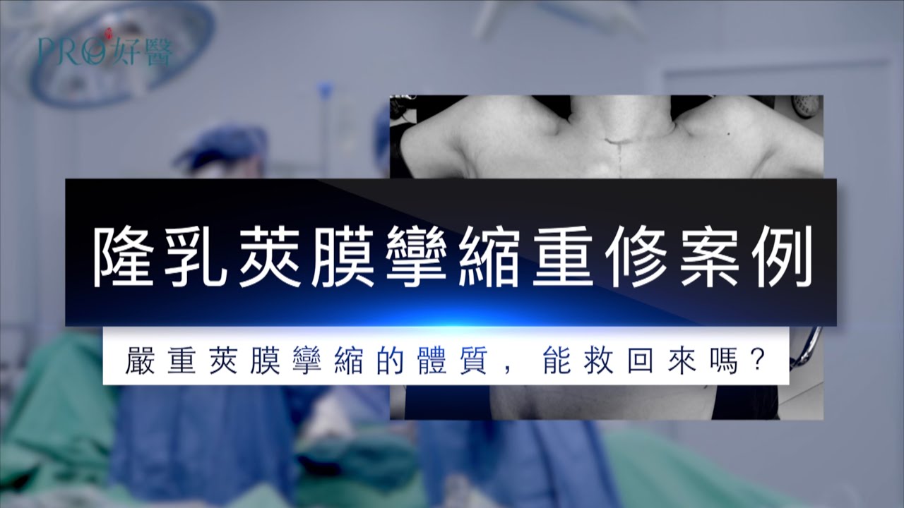 『隆乳術後產生嚴重莢膜攣縮？從韓國來台求救個案！附攣縮圖，慎入』#Pro好醫