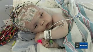 St. Louis baby diagnosed with rare brain tumor survives after surgery screenshot 2