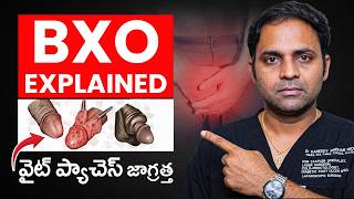 Bxo Foreskin Tightness Ksr Stapler Circumcision For Foreskin Problems Treatment Range Hospital