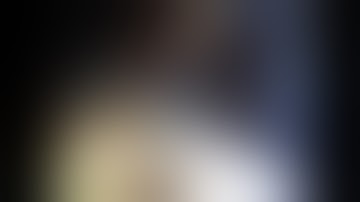 AF treatment with Atricure CryoForm and LAA closure with Atriclip PRO2 during transaxillary MVR