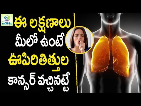 ఉపిరితిత్తుల కాన్సర్ వచ్చే ముందు కలిపించే లక్షణాలు - మన ఆరోగ్యం