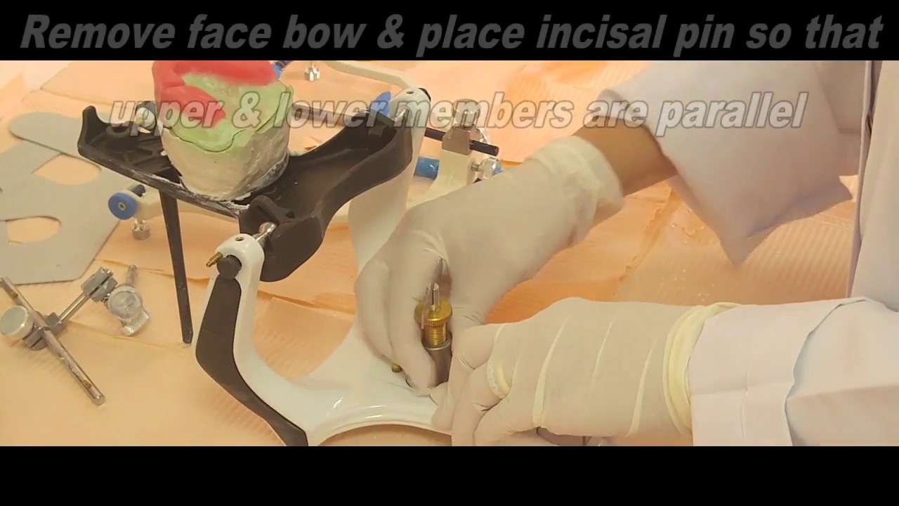 3- Jaw relation record