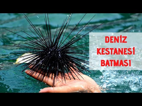 Deniz Kestanesi Batmasında Ne Yapılmalı? | Deniz Kestanesi Batması